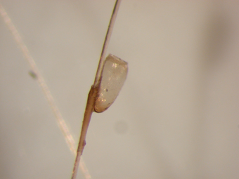 Empty Hatched Lice Egg (Nit): A Sign of Past Lice Activity on the Scalp Empty Hatched Lice Egg (Nit): A Sign of Past Lice Activity on the Scalp