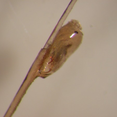Close-up of a Louse and a Nit (Lice Egg): Understanding the Early Signs of Head Lice Infestation Close-up of a Louse and a Nit (Lice Egg): Understanding the Early Signs of Head Lice Infestation