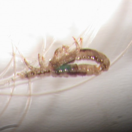Head Lice Mating - they reproduce Head Lice Mating - they reproduce