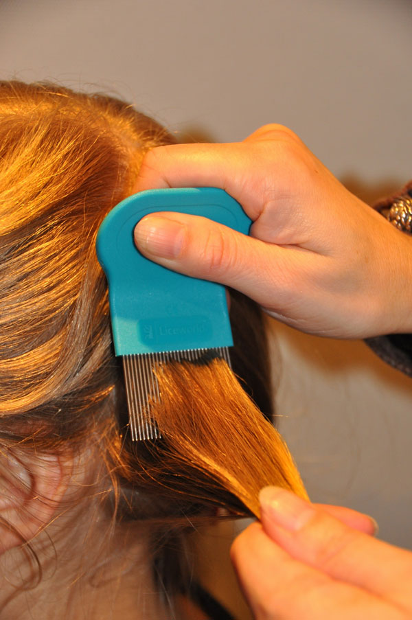 Combing for dead Head lice and living lice and Nits Combing for dead Head lice and living lice and Nits
