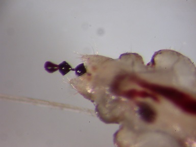 Lice-feces