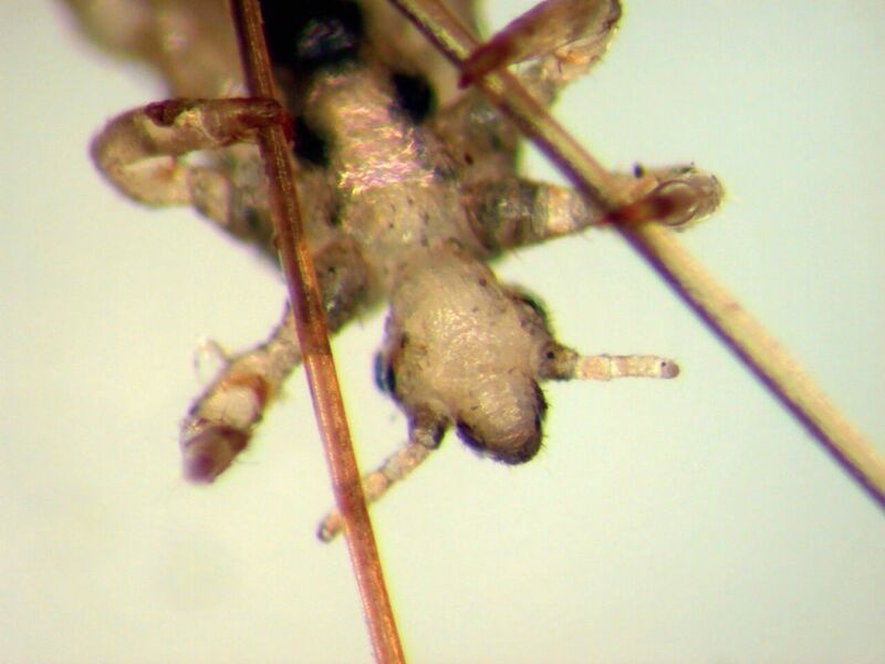 Close up photo of a Louse in a strand of hair Close up photo of a Louse in a strand of hair