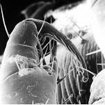 Head louse – close up of leg with receptors Head louse – close up of leg with receptors